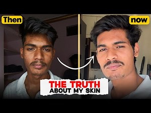 Your Skin Will Change After This Video — My Entire Blueprint