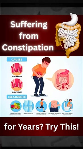 👉 Chronic Constipation - Ayurvedic Treatment and Risk Factors Explained by Expert Ayurvedic Physician ✅ Discover natural Ayurvedic treatment for chronic constipation. Learn effective remedies, risk factors, and holistic solutions for long-term relief. 🌿 For Consultation, Please Contact:- 📞 Call Now: ( 91) 987-699-0609 📧 Email: herbalcac@gmail.com 🌐 Visit: https://www.chandigarhayurvedcentre.com #Ayurveda #DrVaidJi #ConstipationRelief #ChronicConstipation #AyurvedicTreatment #DigestiveHealth