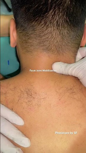 Facet Joint Mobilization #wellness #physiotherapist