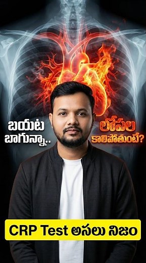 C Reactive Protein test