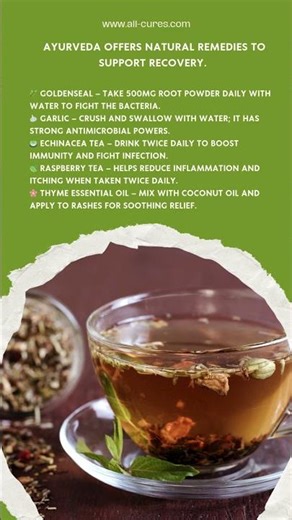 #Ayurveda #parrotfever Treatment For (Parrot Fever) Psittacosis