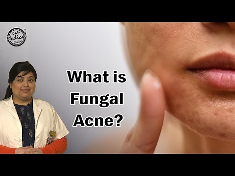 What is Fungal Acne? | How to Get Rid of Fungal Acne? | Fungal Acne Treatments | Dr. Nivedita Dadu