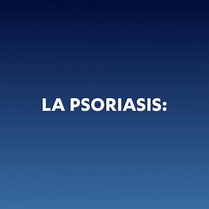 Dos de cada 100 personas en el mundo vive con psoriasis. Sin embargo, la mayoría de las personas realmente no entiende este desorden au | Johnson & Johnson Innovative Medicine Latinoamérica