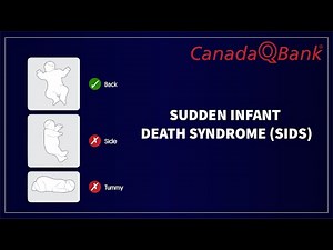 Sudden Infant Death Syndrome (SIDS): Causes, Risk Factors & Prevention | Pediatrics Review