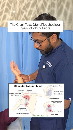 🎯 Clunk Test for Shoulder Labral Tear #physiotherapist #education #physio #painrehabb