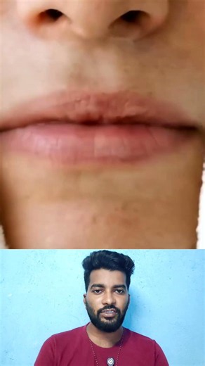 💥👌உங்க உடம்புல தேவை இல்லாமல் இருக்க முடிய remove பண்ண இந்த ஒரு cream போதும் #amazing #quicktips #use
