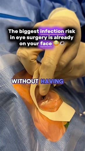 People always ask me… “How do you keep my eye open during surgery?” 👁️😳 It looks intense— almost