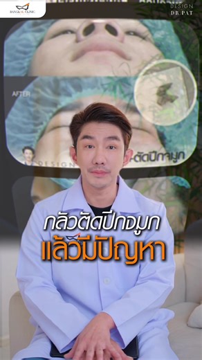 กลัวการตัดปีกจมูกแล้วมีปัญหา 🔺 #bangkokclinicloyalchiangmai #DesignByDrPAT #เสริมจมูก #เชียงใหม่ #ตัดปีกจมูก