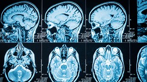 Shock therapy is making a comeback