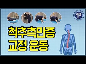 물리치료사가 알려드리는 척추측만증 교정운동