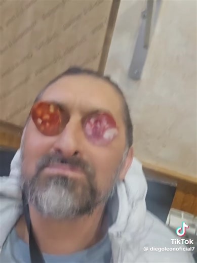 Cambio de color de ojos: un truco gracioso