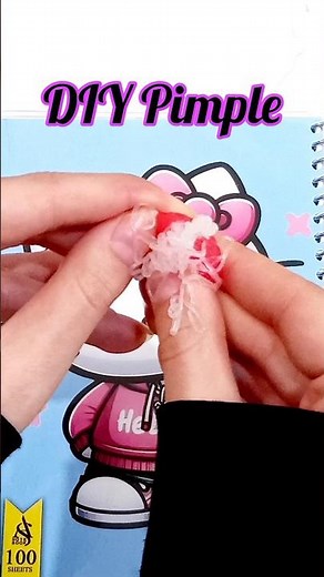 DIY Pimple popping#shorts #diy #diycrafts #craft #craftideas #crafts #tutorial #pimplepopping