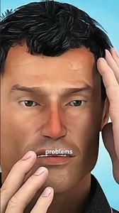 Bruxism or Teeth grinding | causes of tooth decay (3D Animation) #bruxism #teethtok #dentalsplint