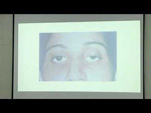 Lecture On Myasthenia Gravis & Neuromuscular Junction: Physiology Lecture | MBBS