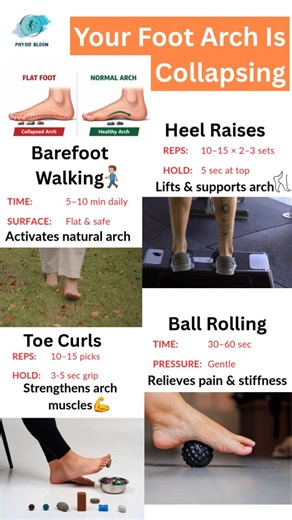 Physio Bloom on Instagram: "Your Foot Arch Is Collapsing — Do These Exercises Daily👣 Collapsed foot arch or flat feet can cause foot pain, heel pain, knee stress, and poor balance. If your foot arch is collapsing, these simple daily exercises can help strengthen your feet and support your arch naturally. 🦶 Exercises Included: 1️⃣ Heel Raises Slowly rise onto your toes and lower down with control. 👉 Helps lift and support the foot arch. 2️⃣ Ball Roll Under Foot Roll a ball under your foot gent