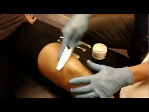 Graston Technique Treatment for Knee Injury • Video • MEDtube.net