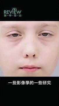 REVIEW醫學雜誌 Vol 40 王安國 教授｜眼科醫學會年會亮點「眼球運動機制」到「不要害怕眼球運動」