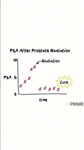 "I had prostate radiation—how does my PSA level guide follow-up and future treatment?”