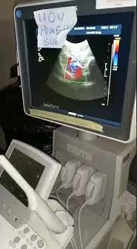 PHILIP IU22 ULTRASOUND MACHINE