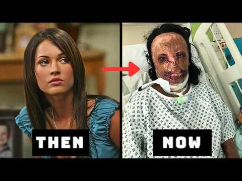 Celebrities Unrecognizable Faces Over Botched Plastic Surgery | Before & After Transformations