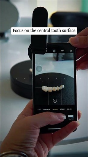 How to Use a Macro Lens for Perfect Close-Up Shots 📸| Dental Kits