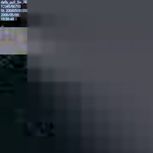 Will transplanted body parts be 3D-printed in the not-too-distant future? | Freethink