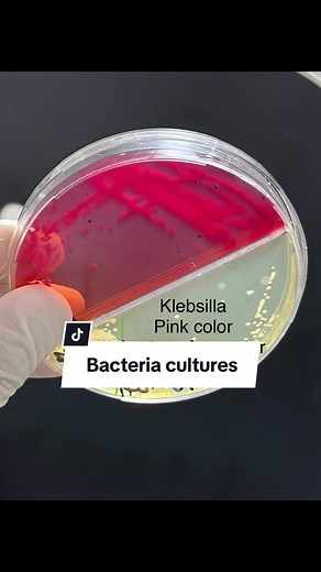 Bacteria cultures 🧫 #abader_ehab #bacteria #microbiology #gramnegativebacteria #coliformbacteria #klebsiella #staphylococcus