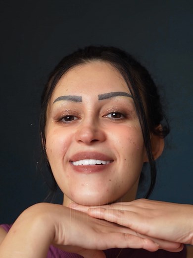 Medico Clinic got the skill to take smiles from bad to beautiful 🦷 . . . . . . #medicoclinic #dentalimplants #hollywoodsmile #zirconium #dentalveneers #emaxveneers #zirconiumcrowns #dentalcrowns #emax #dentalclinics #teeth #smile #dentaltransformation #dentalimplantsturkey #istanbul #turkey