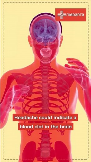 Head Injury After an Accident? Don’t Ignore the Signs