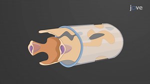 Video: Capillaries and Their Types