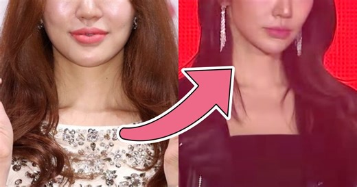 K-Pop Idol Netizens Claim "Ruined" Her Face Goes Viral For Her Recent Visuals