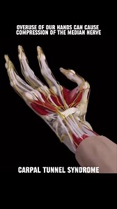 1.6M views · 3.9K reactions | What causes Carpal Tunnel Syndrome | Physical Therapy Session | Facebook