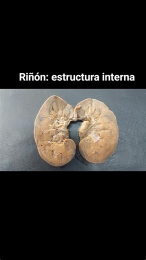 Estructura Interna del Riñón: Corteza y Médula Renal