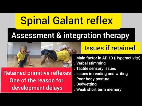 Spinal galant reflex/how to integrate retained spinal galant reflex/OT/primitive reflex integration