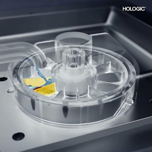 All-in-One Procedures with Brevera® Breast Biopsy System