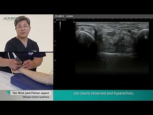 Musculoskeletal Ultrasound (Wrist and Hand) 01.Wrist Palmar aspect