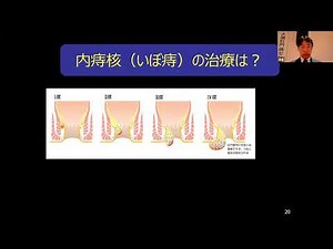 人には聞けない、おしりのはなし #痔 #肛門科