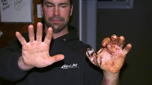 Gun Maker's Exploding Rifle Leaves Trail of Injured Hunters