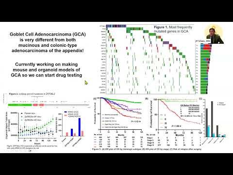 Updates on the Study of Appendix Cancer - JP Shen, MD - MD Anderson Cancer Center