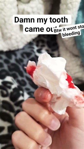 STOP BLEEDING DAMNIT-#ithurts #AAAH