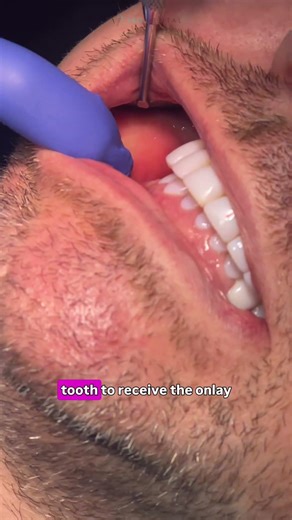 Pro Dental Clinic London