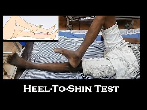 Heel-To-Shin test | Assesment of coordination