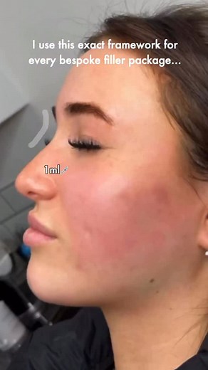 I didn’t wake up one day creating results like this. I built them — the hard way. 15 years in clinic. Endless advanced trainings. Different methodologies, different mentors… until I finally refined everything into one framework rooted in precision mapping, controlled placement, and natural, premium aesthetic outcomes. It’s the exact framework I now teach my students to transform the entire face. Comment FW and I’ll send it straight to you 💬✨ #aestheticsacademy #aesthetics #masterclass #trainher