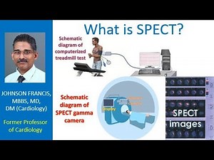 What is SPECT?