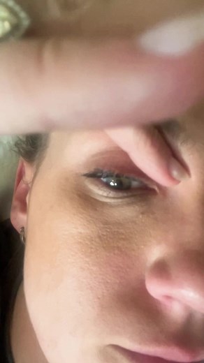 Understanding Sinusitis: Eye Noises and Symptoms Explained