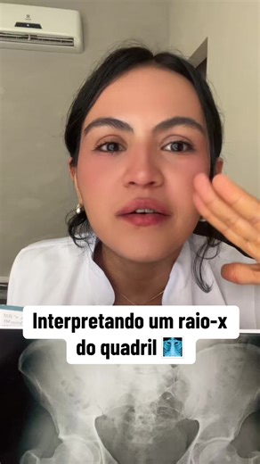 Muita gente faz um exame de imagem, vê que “está tudo normal” e fica sem entender por que ainda sente dor. 👀 Mas nem toda dor aparece no raio-x. Por isso o exame físico e os testes ortopédicos são tão importantes na fisioterapia. Eles ajudam a identificar alterações musculares, ligamentares, limitações de movimento e outras causas que muitas vezes não aparecem no exame de imagem. O exame é importante? Sim. Mas ele sempre precisa ser relacionado ao que o paciente realmente sente. ✅ Você já receb