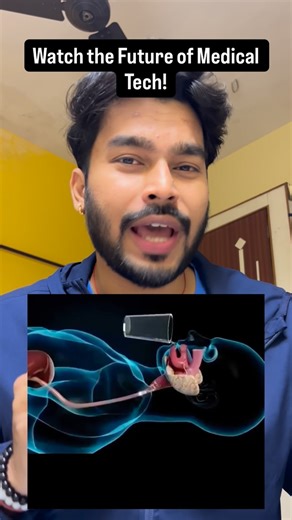 Siddharth Selvan 🇮🇳 on Instagram: "China’s AI-powered swallowable capsule just changed stomach scans forever! 🙌 No tubes, no pain, no anesthesia — just swallow and let the tiny AI capsule do the rest in about 8 minutes! ⏱️ It captures images, analyzes your stomach with smart tech and gives fast, painless results 🧠📊. Affordable 👛 and super comfy, this breakthrough could help more people get checked without the usual anxiety 💪. Watch to see how this future tech is transforming digestive hea