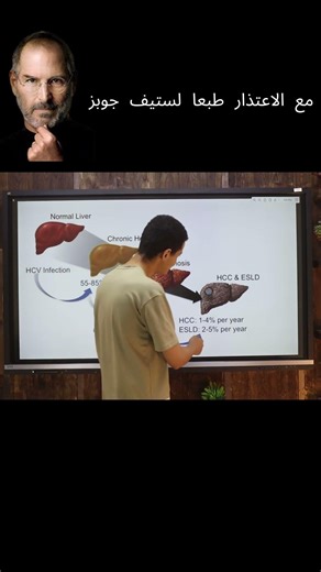 @Apple #apple #steve_jobs #hepatitis #كلية_الطب #funny #comedyshorts #السعودية #مصري #الوطن_العرب