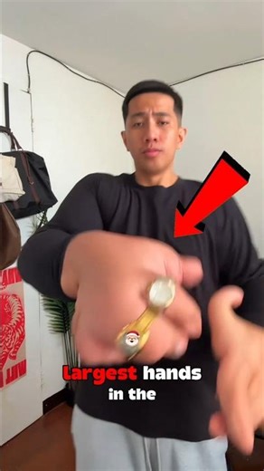 Why Are His Hands Enormous? 😲