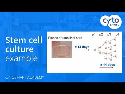 Example of a stem cell culture - CytoSMART Academy